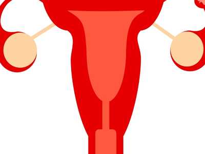 Ectopic Pregnancy
